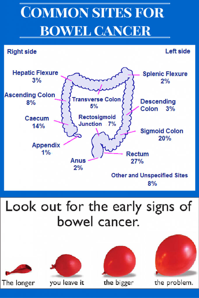 bowel-cancer-demystified-docbeecee